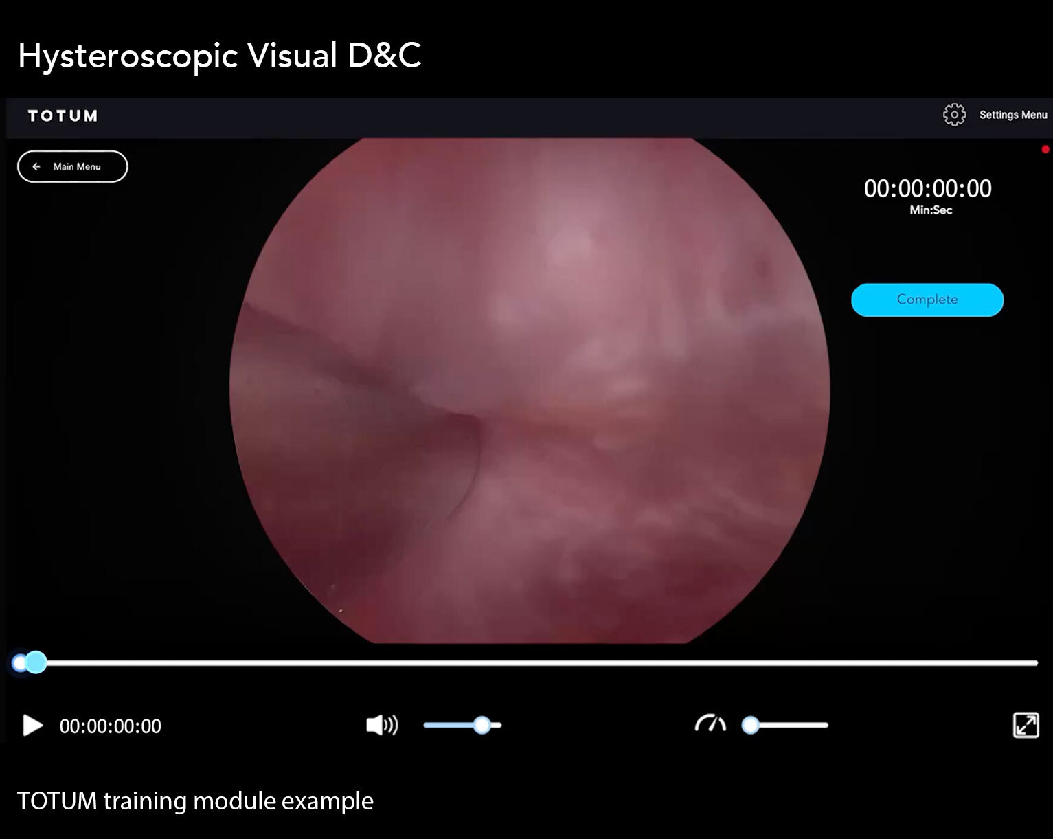 Hysteroscopic Visual D&C